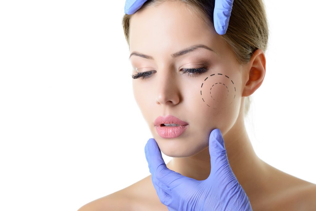 Una cara más fina: la nueva moda en cirugía estética