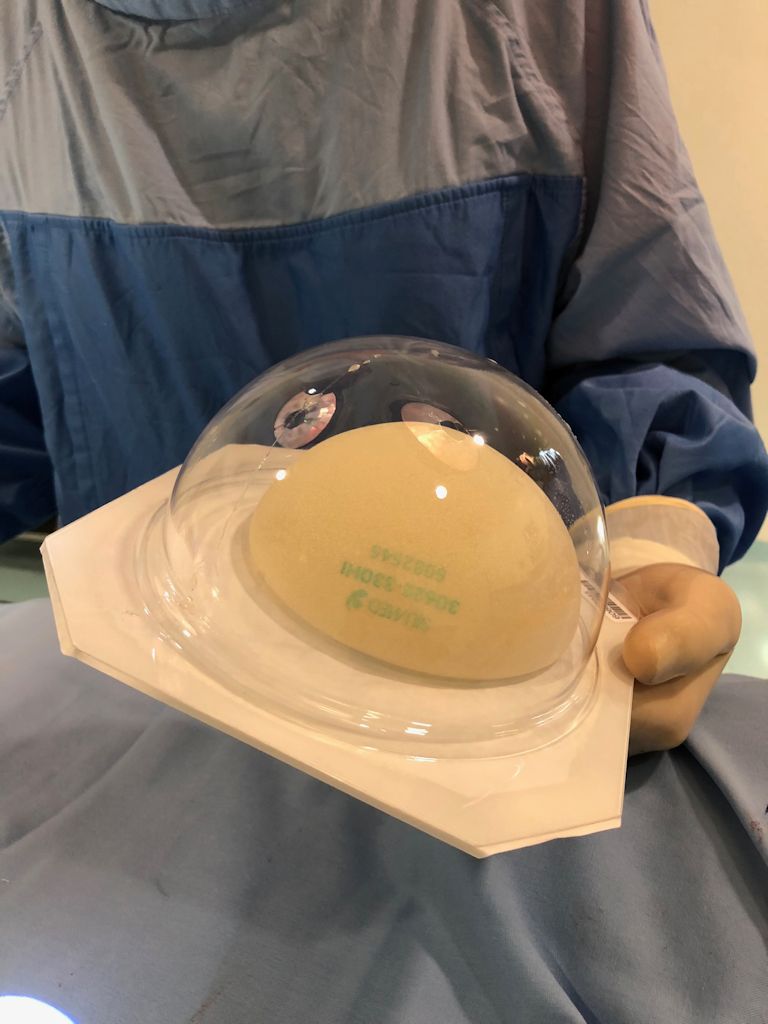 Cápsula Fibrosa por implante mamario