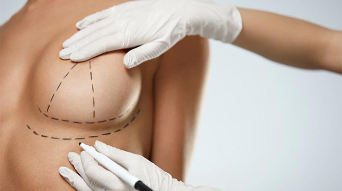 Células madre de grasa corporal para la reconstrucción de pecho