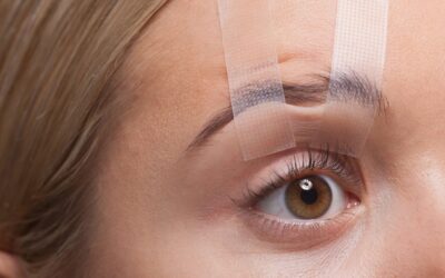 Cirugía de los párpados: Cuidado Postoperatorio